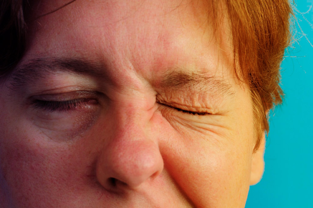 simptomele și tratamentul inflamației faciale