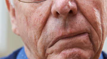 Preventia accidentului vascular cerebral