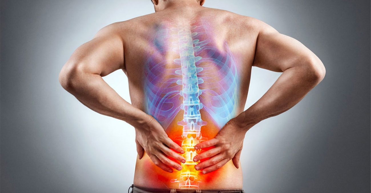 lombosciatica