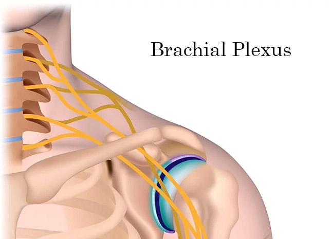 plexul brahial