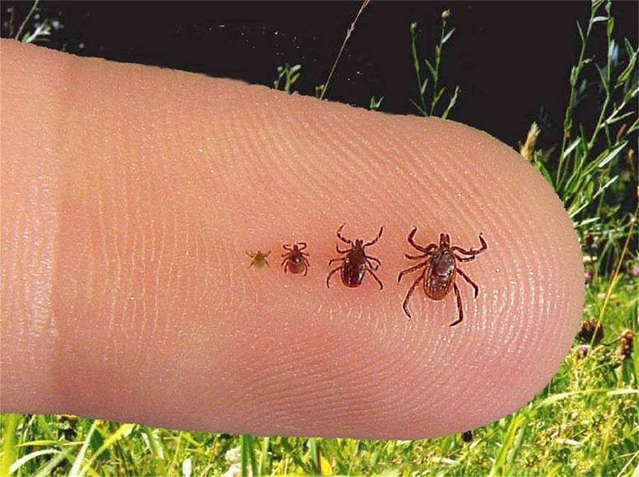 tick encephalitis